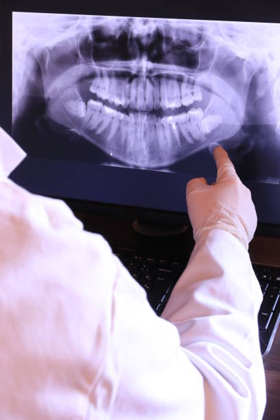 Best Emergency Dental Care for Broken or Chipped Teeth in Loudon, TN